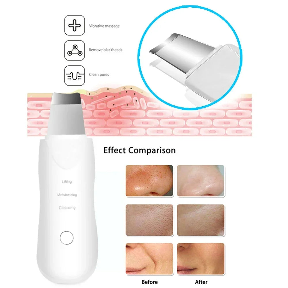 GlowPro Skin Scrubber